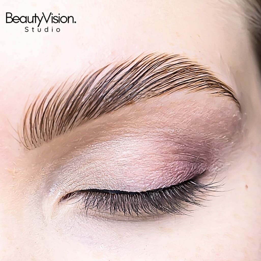 Augenbrauenlifting Browlifting